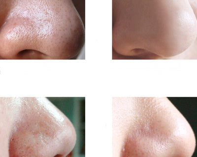 Bamboo charcoal blackhead nasal mask cream shrink pores to black set suit black thorn cream